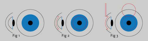 EASYVISION - Clinique de la vision