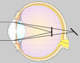 EASYVISION - Clinique de la vision