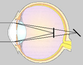 EASYVISION - Clinique de la vision