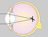 EASYVISION - Clinique de la vision